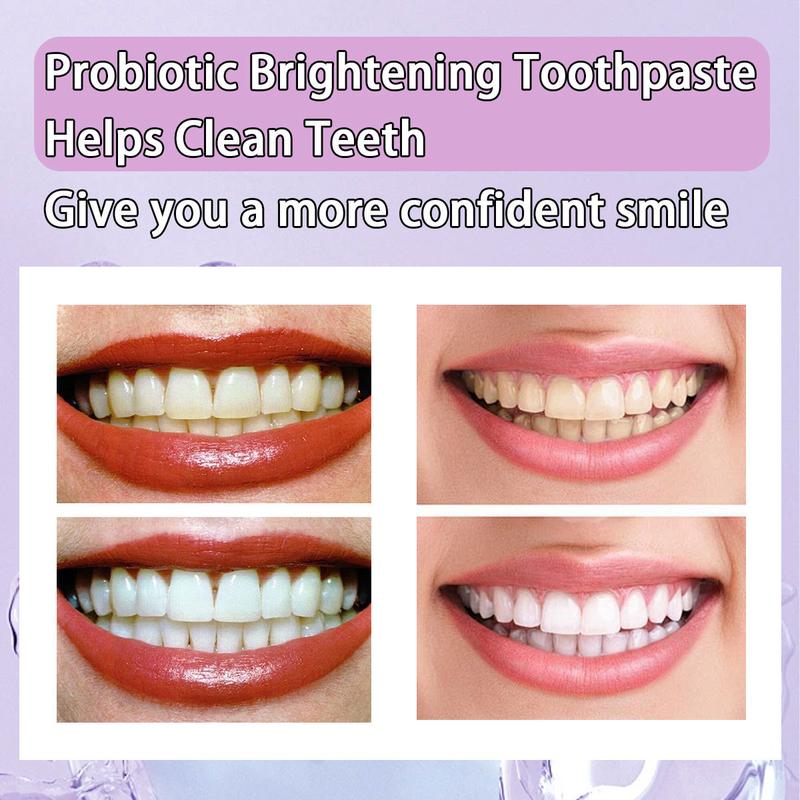 SP-6 Toothpaste Oral Health Management,Remove smoke stains,Probiotic Toothpaste for Oral Health Management and Fresh Breath, with Sodium Saccharin and Lactobacillus,Hydroxyapatite, Whitening Toothpaste, Fights Plaque.