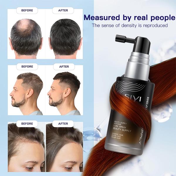 SIYl - Hair Growth Spray, Prevent HairLoss & Promote Healthy Scalp