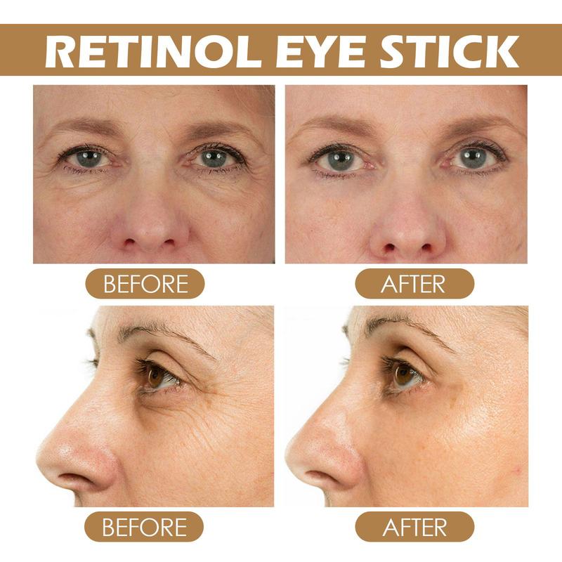 Eye Cream Stick - Retinol Eye Cream reduces eye bags, dark circles and eye wrinkles, provides moisture and nutrition to the eye area