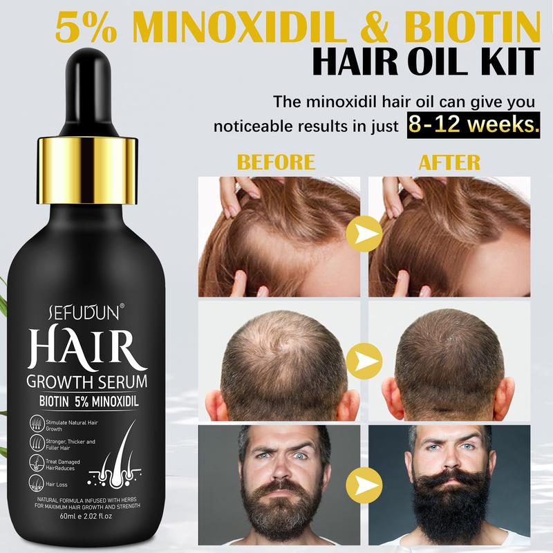 Sefudun 5% Minoxidil Hair Serum for Men and Women, Hair Care Serum for Thicker Longer Fuller Hair, with Hair Roller Set