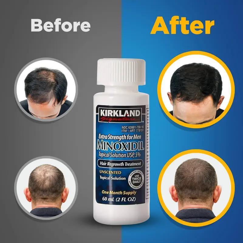 Kirkland Signature Minoxidil Liquid Extra Strength Hair Regrowth Treatment for Men, 5% Topical Solution - Comfort, Haircare