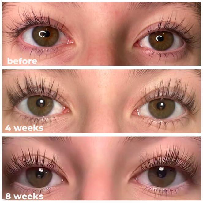 nuorganic eyeLash Growth Serum - Thicker + Longer + Stronger Eye Lashes in 30 Days - Natural + Vegan + Cruelty Free - As Seen on Tiktok! Extra Large Bottle + 3 Month Supply - 0.3 fl Oz   8ml