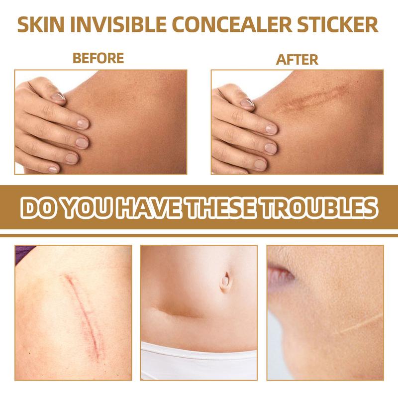 Skin invisible concealer patch Skin scar tattoo acne mark cover patch skin color invisible patch waterproof Foundation Makeup