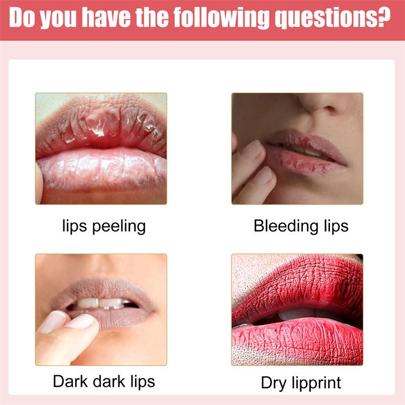 Remove Dark Smoke Lips Pink Fresh Lightening Bleaching Cream Treatment  Lip Balm Whitening Moisturizer Nourishing Essence Lips