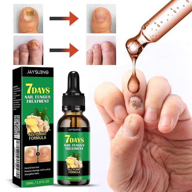 (Free Shipping) JAYSUING Ginger Nail Treatment Support Nail Care with Vitamin E and Plant Essential Oils- toes  nail paronychia beriberi Onychomycosis Nail deformation. Comfort Nail Polish Manicure Nail Art