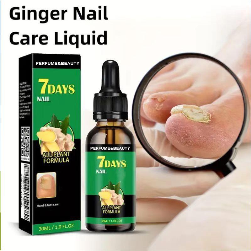 (Free Shipping) JAYSUING Ginger Nail Treatment Support Nail Care with Vitamin E and Plant Essential Oils- toes  nail paronychia beriberi Onychomycosis Nail deformation. Comfort Nail Polish Manicure Nail Art