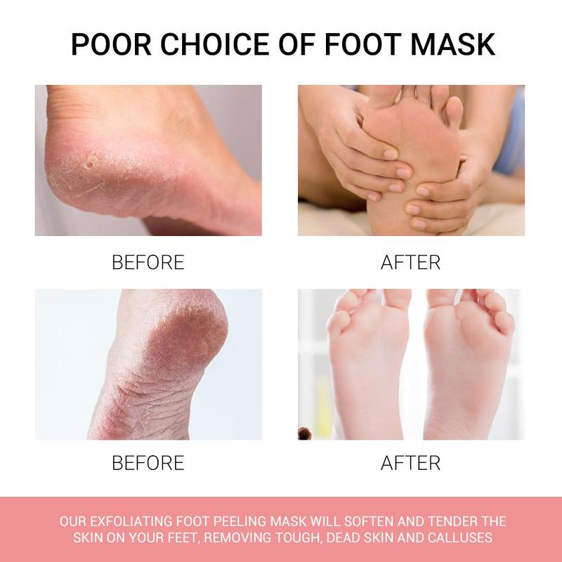 Peach Flavor Peeling Foot Mask, 3pcs set Exfoliating Foot Patch, Foot Care Product for Dry Cracked Skin