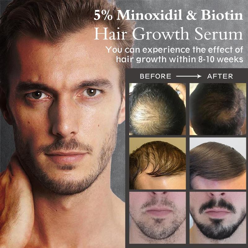 Hair Growth Treatment for Thicker Longer, 5% Minoxidil Biotin Hair Growth Serum Oil for Men and Women, Prevents Hair Loss and Thinning, 2.11 fl.oz