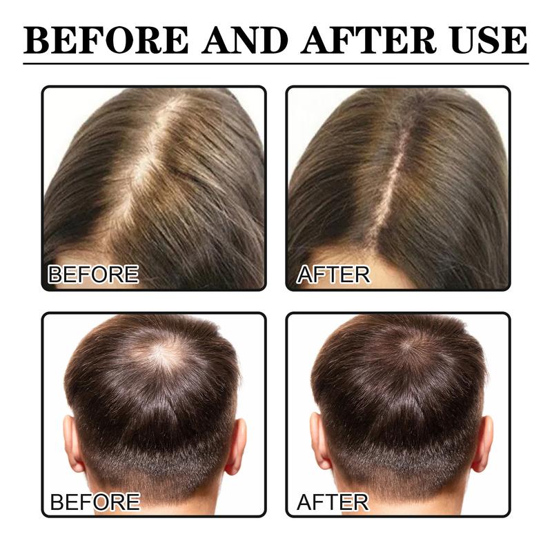 [Free shipping]Hair Growth Serum Oil Biotin Hair Regrowth Treatment for Scalp Hair Loss Hair Thinning for Men Women