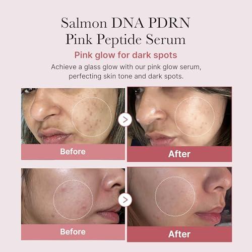 medicube Salmon DNA PDRN Pink Peptide Serum, Pink glow serum, Peptide, Niacinamide, Hydrating & Moisturizing & Firming, Uneven Skin Tone, Korean Skincare | 1.01 fl.oz. (1.01 fl.oz., Salmon DNA PDRN)