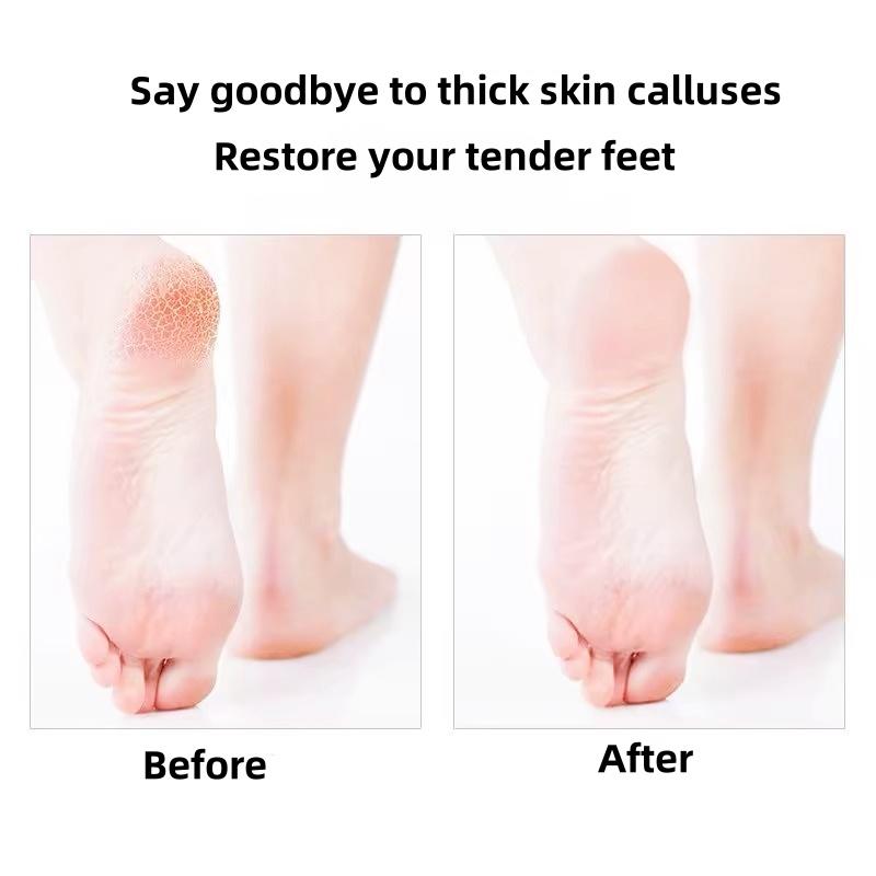 Foot rub version-delicate to the foot, thick surface design, exfoliate, except the calluses wear cuticle, fine, smooth feet, double-sided foot rub board, care foot health